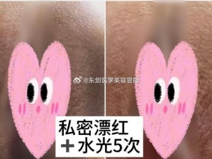 女性私密部位肥大、黑色素沉淀怎么办？