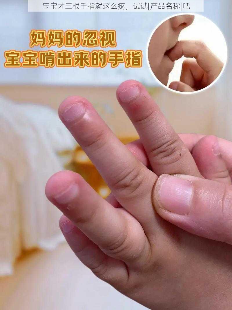 宝宝才三根手指就这么疼，试试[产品名称]吧